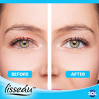 Dry Eye Spray 15ml Hydrating Mist for Irritated Eyes | 2 Pack