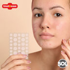 Cold Sore Patches | Acne Spot Pimple Hydrocolloid Breathable | 72 Pack