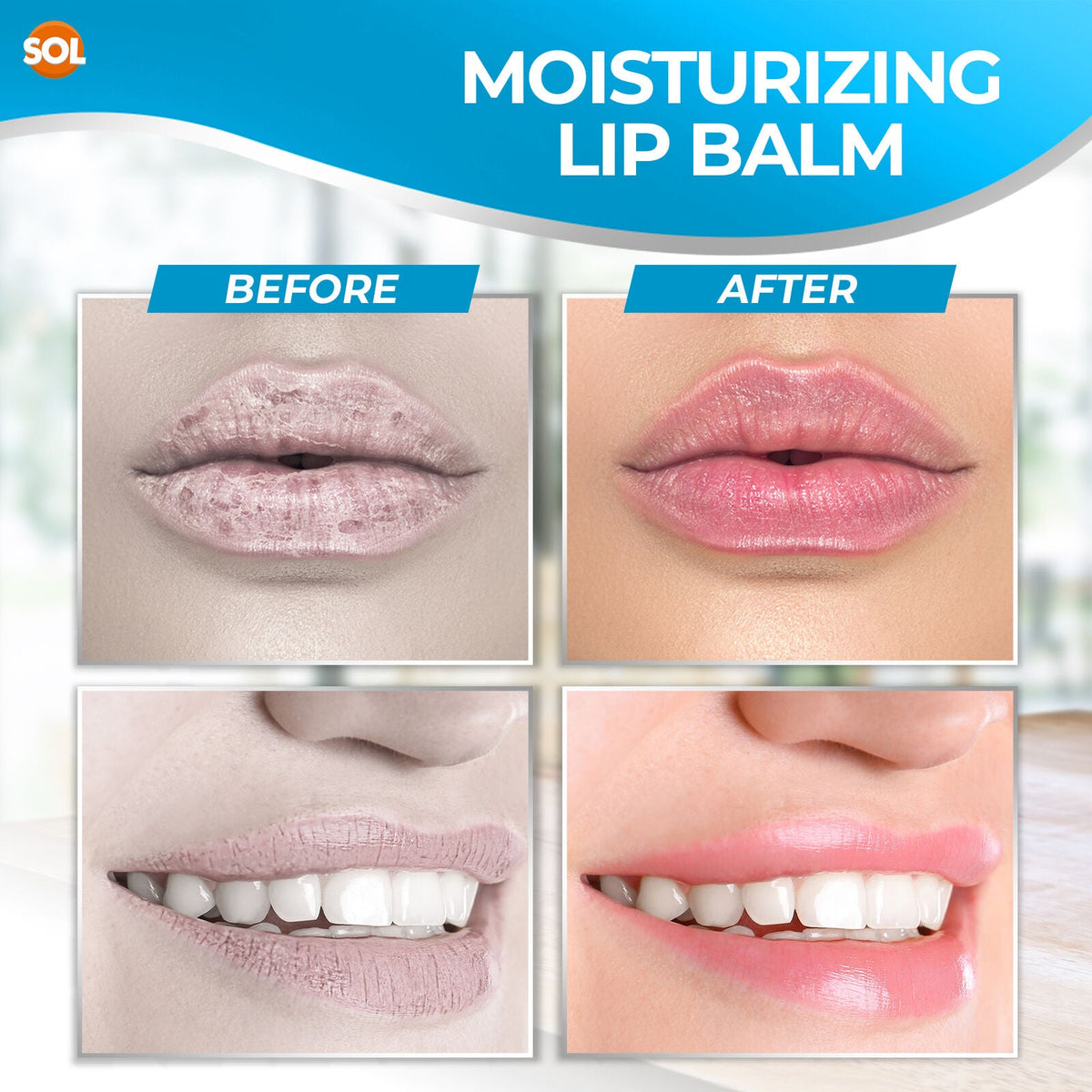 SOL Unscented Lip Balm Multipack - Moisturiser & Hydrating Lipbalm for Men and Women, Repair for Dry, Chapped Lips With Vitamin E, Long-Lasting Lip Care Sticks for Home, Office, or On-the-Go Use