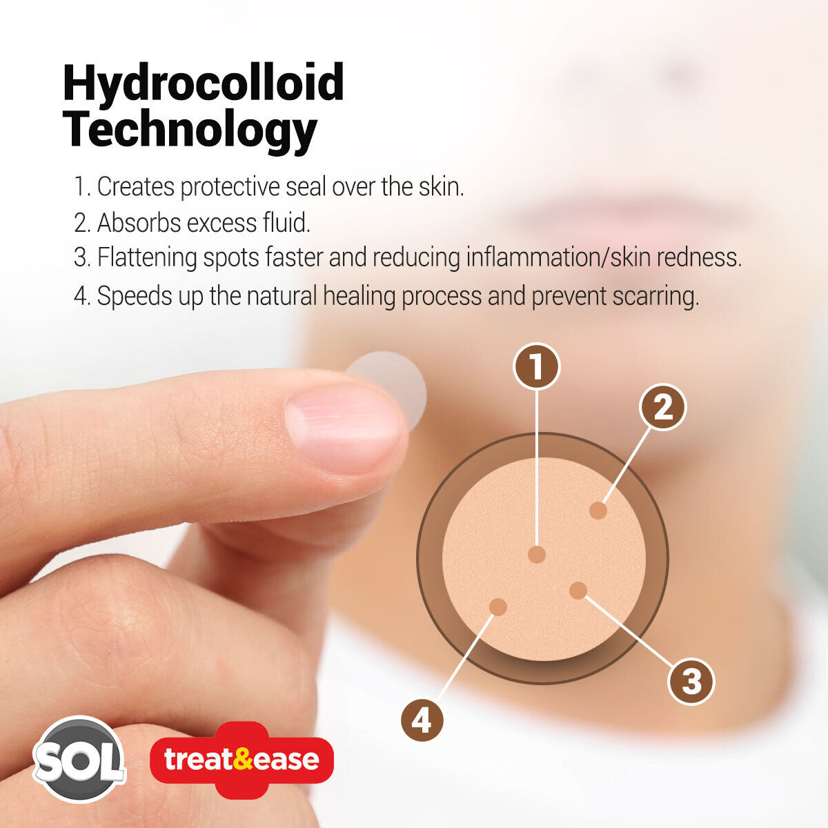 Cold Sore Patches | Acne Spot Pimple Hydrocolloid Breathable | 72 Pack