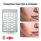Cold Sore Patches | Acne Spot Pimple Hydrocolloid Breathable | 72 Pack
